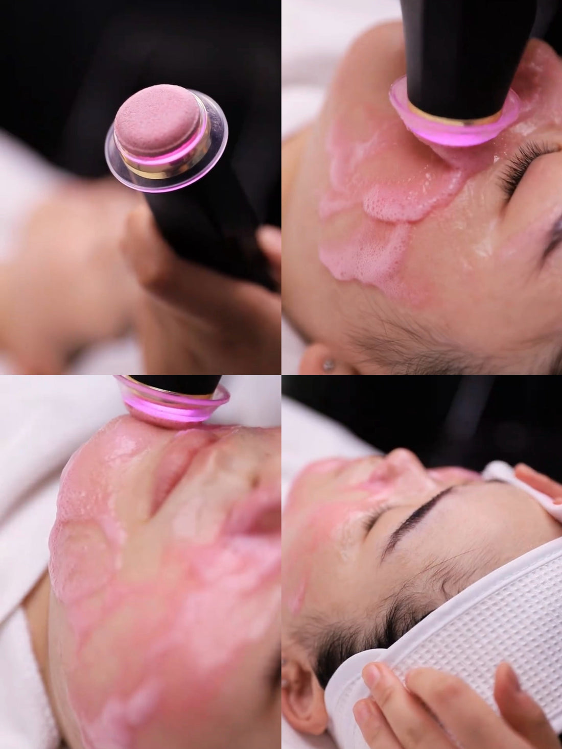 CO2 Oxygen Facial Machine: The Next-Generation Treatment Every Beauty Salon Should Offer in 2026