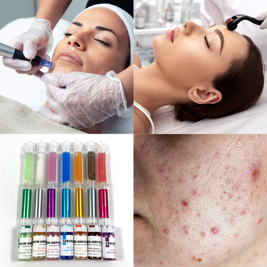 Liquid Microneedling Kit – Safe, Non-Invasive Collagen-Boosting Facial Treatment