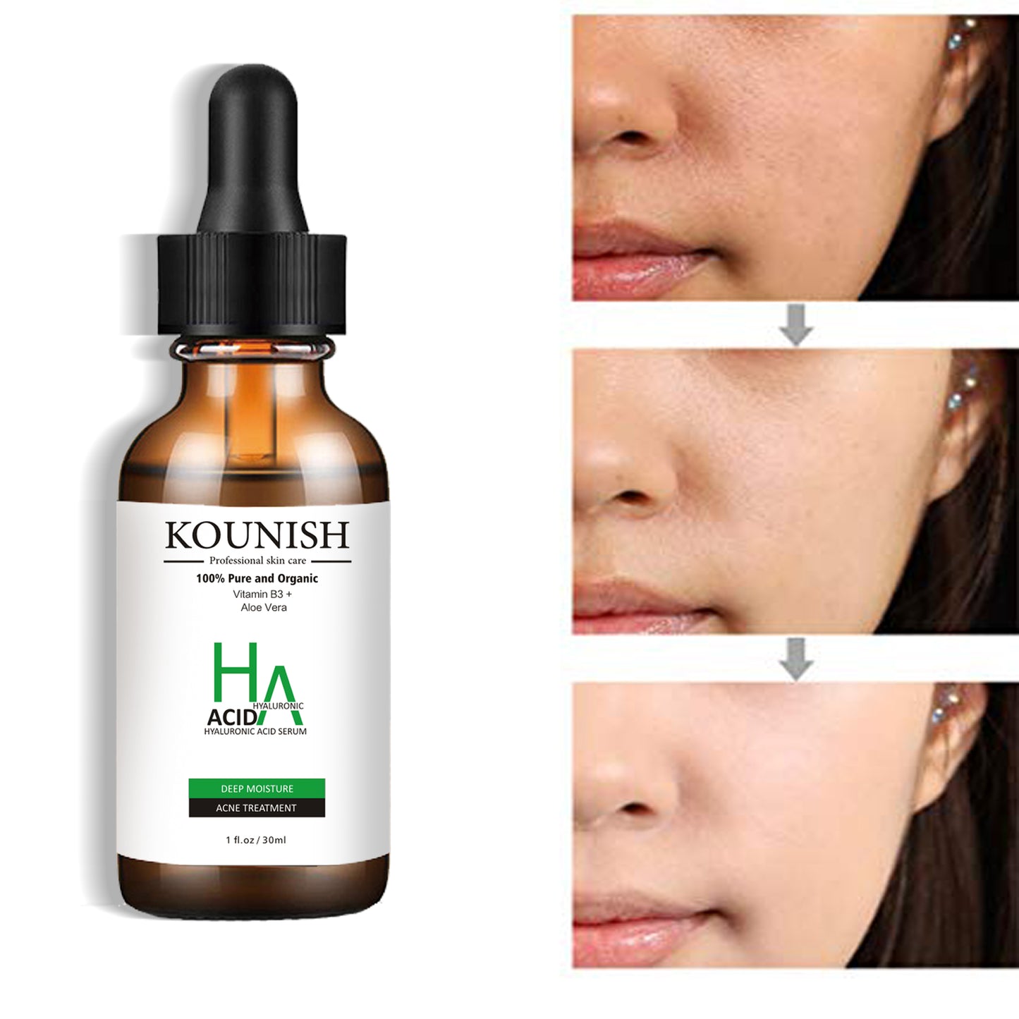 Hyaluronic Acid Facial Serum 30ml